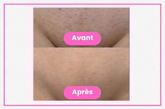 Lady Shaver • Épilateur Électrique